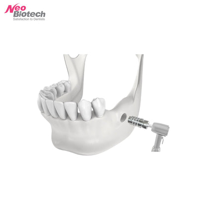 ACM Autobone Chip Maker - Bone Harvesting Burr