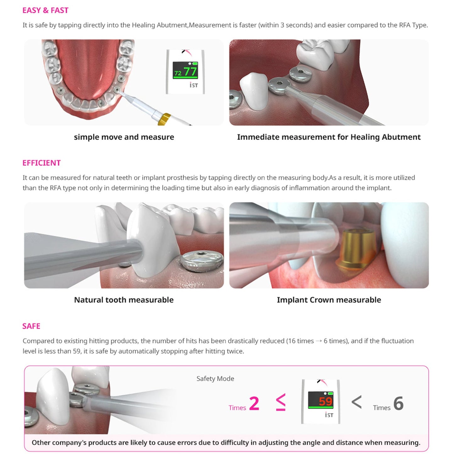 Anycheck Osstell Device - Dental Implant Stabilty Tester