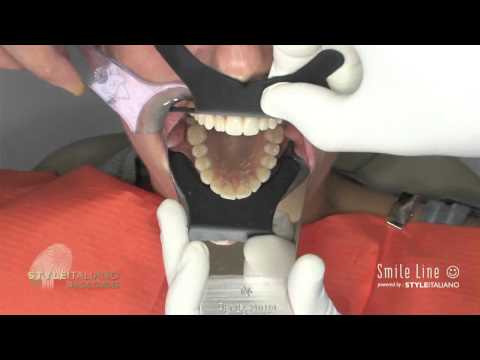 FlexiPalette Set - Black Contrastors For Intra-Oral Photografy