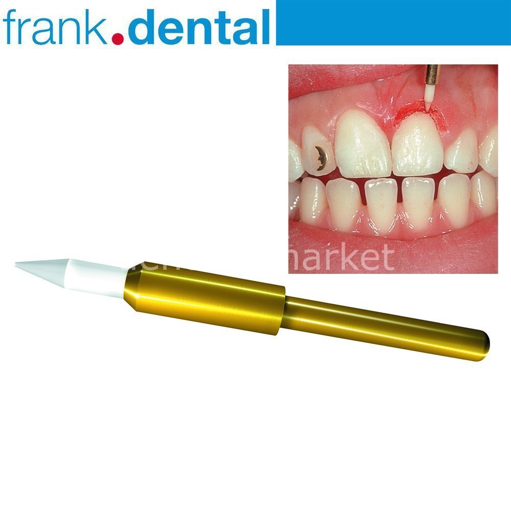 Frank Dental - Soft Tissue Gingiva Trimmer Burs - Ceramic Gingiva Bur - GT48L - STT249