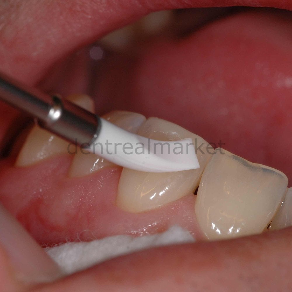 A-Dapt Aesthetic Silicone Composite Shaping Intruments Kit