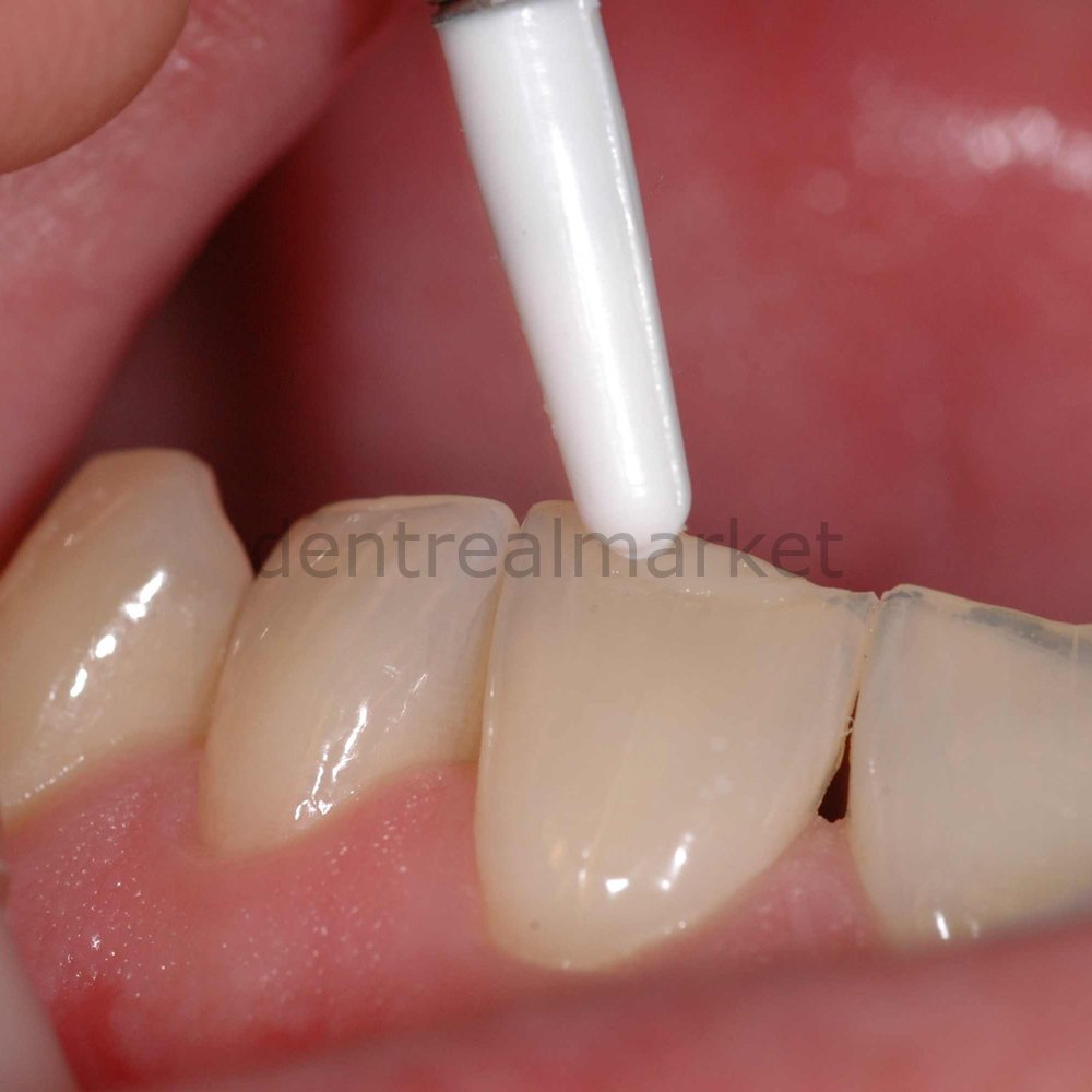 A-Dapt Aesthetic Silicone Composite Shaping Intruments Kit